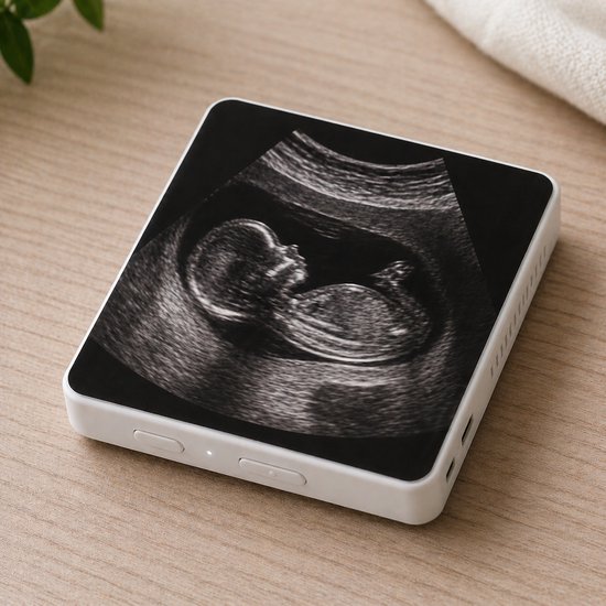 Echofoto-geluid- Magneet – Gepersonaliseerd Cadeau Zwangerschap – Unieke Herinnering Baby Aankondiging van Merkloos