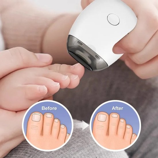 Elektrische automatische nagelknipper, 3-in-1 automatische nagelslijper met 3 snelheden, universele automatische nagelslijper, stille automatische nageltrimmer en -polijster voor het hele gezin van Merkloos