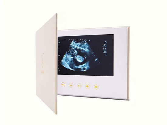 Kiekeboek Créme - Digitaal Babyboekje | Herbeleef echo's en de eerste momenten - Origineel zwangerschapscadeau van Merkloos