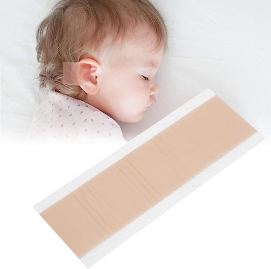 Siliconen esthetische correctiepatroon voor baby's - 2 x 100 cm - oorcorrectie - pasgeboren baby - afstaande oren