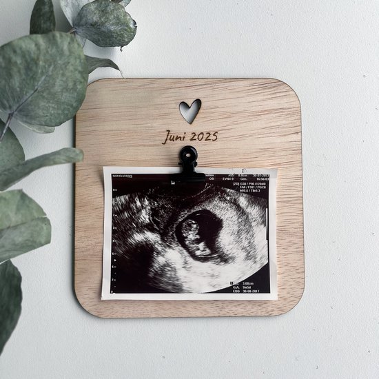 Zwangerschapsaankondiging - Echo - Baby echo - Zwangerschap bekendmaken